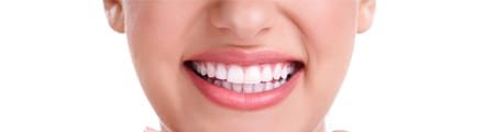 Teeth Whitening Cost in delhi